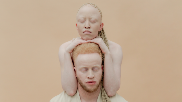 Bielactwo w oparciu o Totalną Biologię